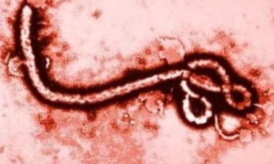 โรคติดเชื้อไวรัสอีโบลา-Ebola-คืออะไร